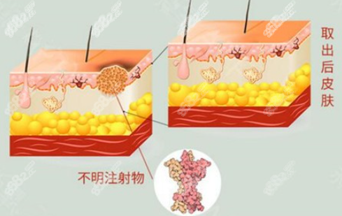 取生长因子过程图示
