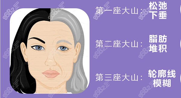 深圳南雅医院张永新微拉美技术优势