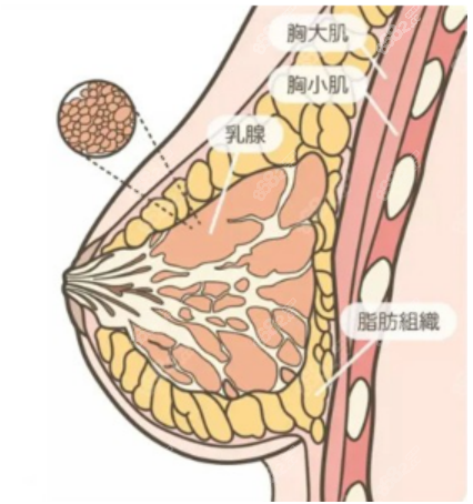 美莱栗勇缩胸