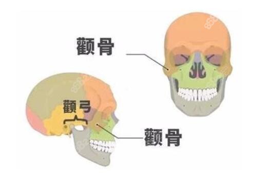 做颧骨内推怎么样