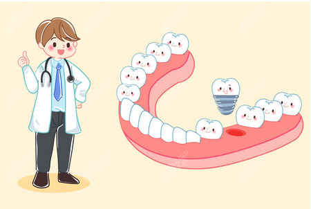 杭州植得口腔种植牙价格表