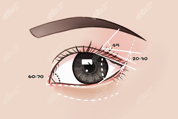 韩国性价比高的眼修复医生李相均