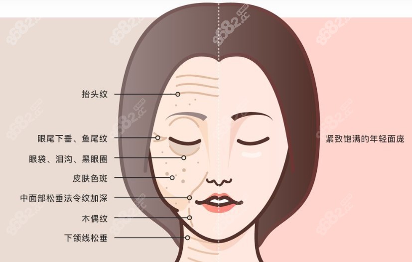 韩国必妩整形面部提升价格16000元起