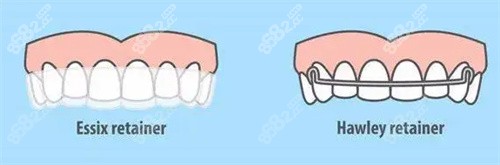 哈雷保持器和隐形保持器对比图