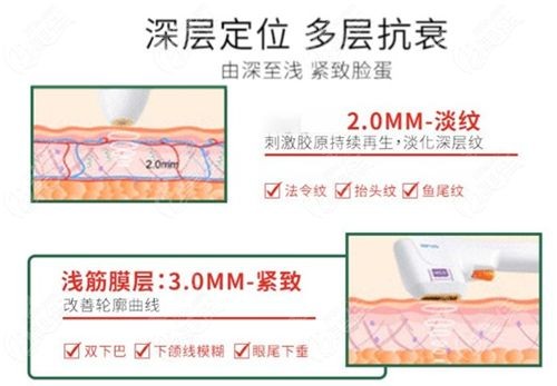 做超声炮好处盘点（超声炮抗衰优点）m.8682.cc.jpg