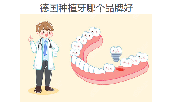 德国种植牙哪个品牌好