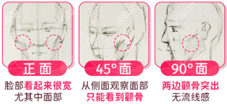 柳超医生磨骨技术特点