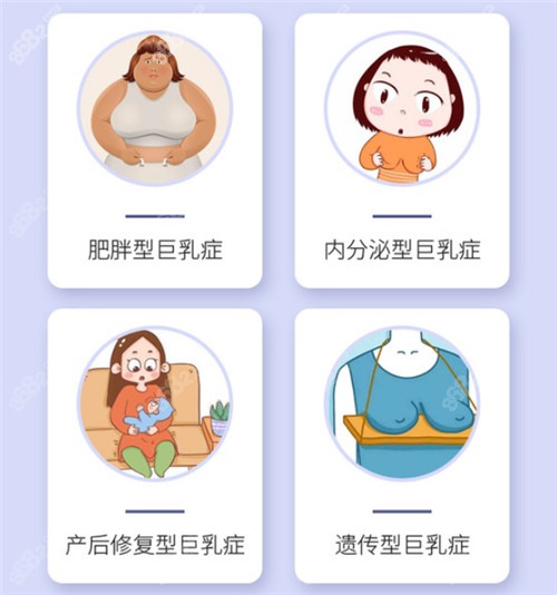 巨乳的不同类型展示