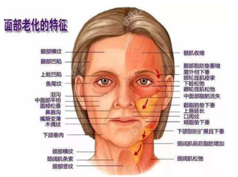 加减美V6面部提升