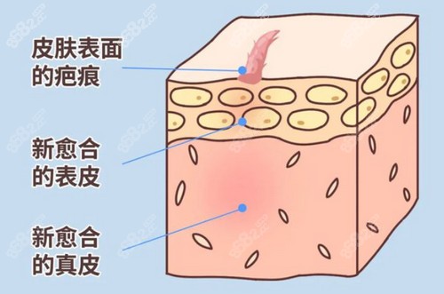 昆明昆大党永明医生疤痕治疗技术娴熟