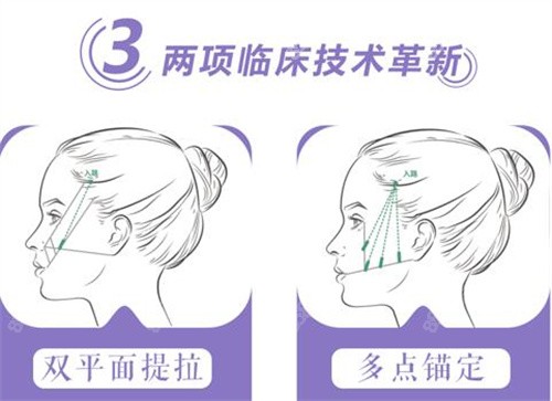 深圳南雅拉皮手术技术优势