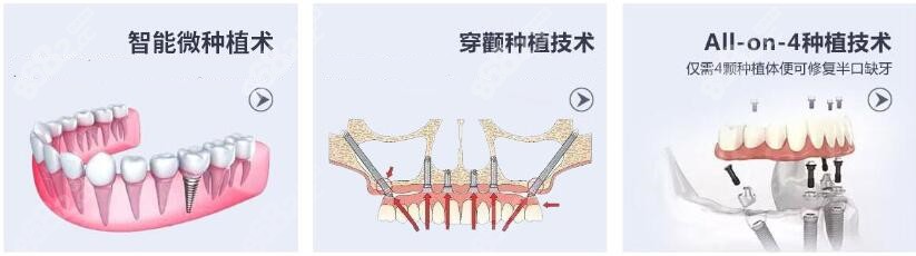 广州穗华口腔种植牙技术好