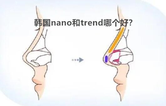 韩国nano和trend哪个好