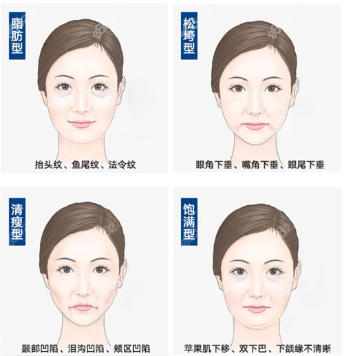 不同松弛衰老的类型