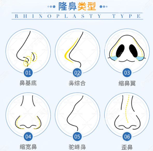 范荣杰医生隆鼻怎么样