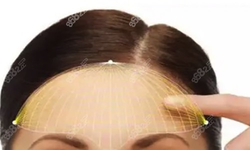 成都艺星和米兰柏羽哪家好