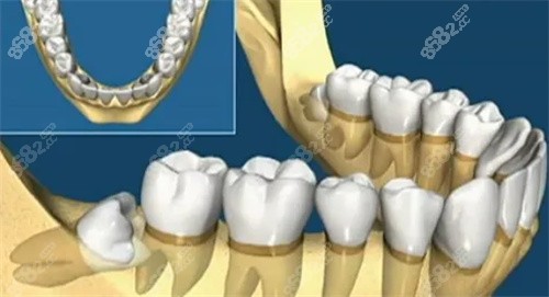 牙科數(shù)字化分析圖
