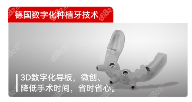 数字化导板种植牙的利和弊