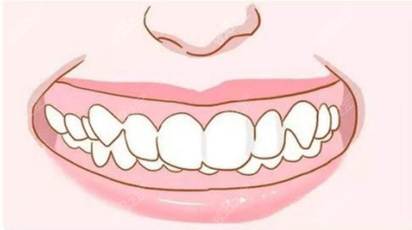 深圳愛康健口腔醫(yī)院牙齒矯正 深圳愛康健口腔醫(yī)院牙齒矯正