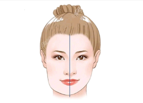 顴骨不對(duì)稱(chēng)的表現(xiàn)