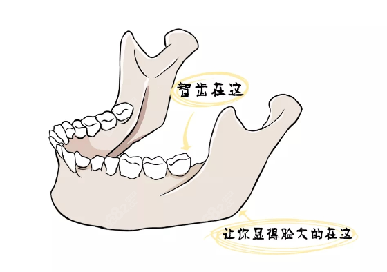 贵阳正颌手术费用