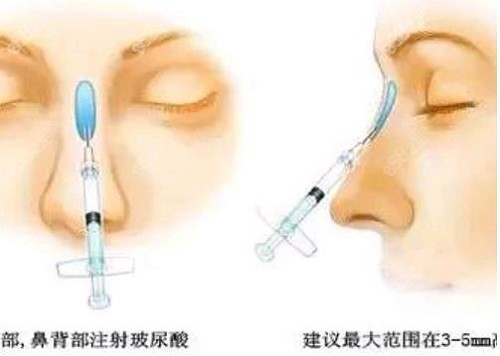 乔雅登雅致和致和丰颜的区别是什么？