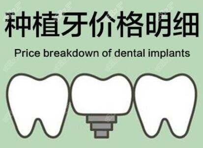 鹰潭种植牙的价格