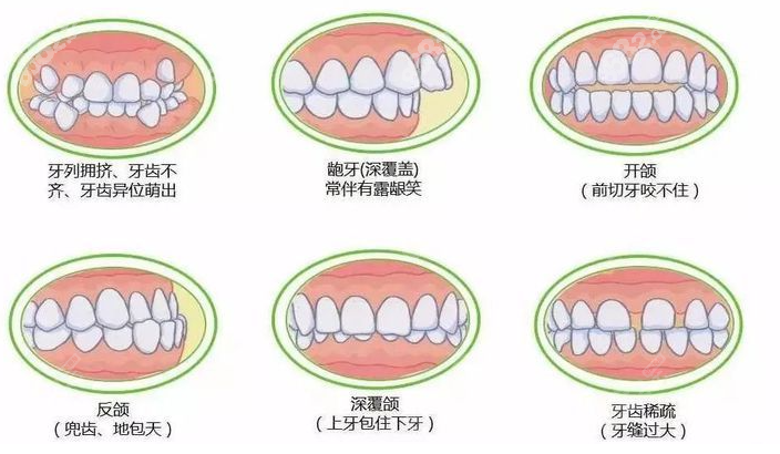 唯美口腔牙齿矫正价格多少贵吗？