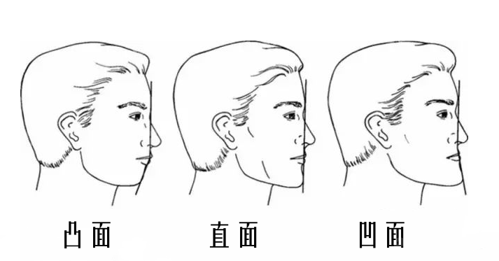 贵阳正颌手术