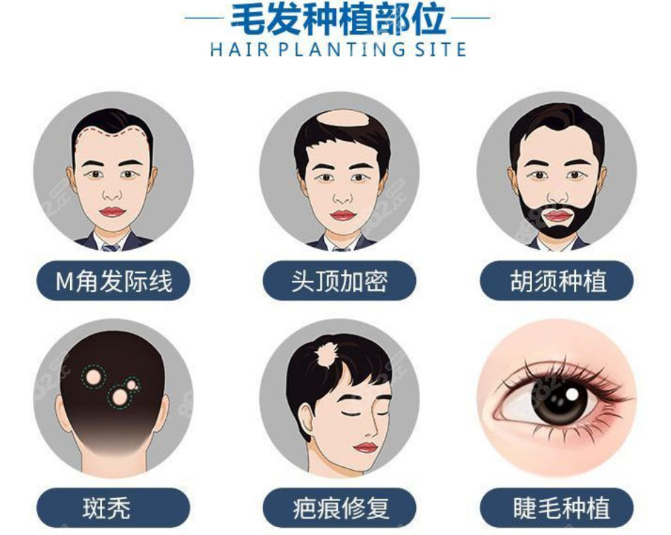 <!--<i data=20240705-sp></i>-->植发价格 <!--<i data=20240705-sp></i>-->植发价格