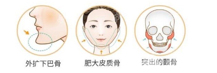 韩国美迪莹轮廓多少钱www.8682.cc