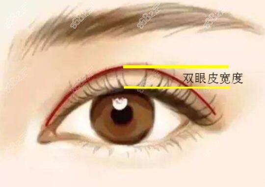 上海杨国正做双眼皮怎么样m.8682.cc