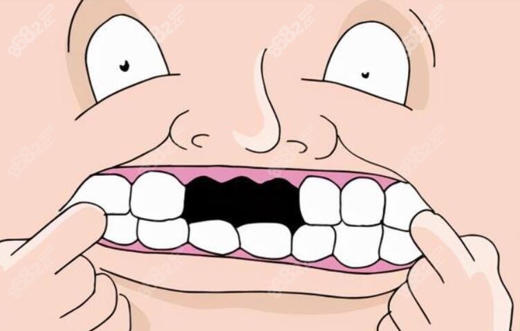 三颗牙齿缺失怎么办www.8682.cc