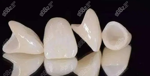大门牙出现裂痕怎么修复？