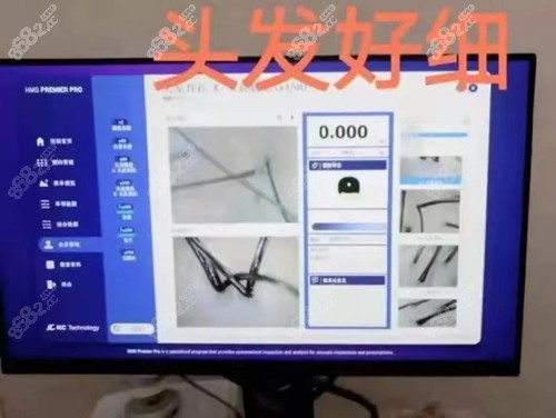 <!--<i data=20240705-sp></i>-->植发医院正规吗？
