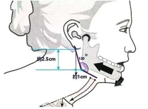 下颌角手术留角和不留角的区别对比m.8682.cc.jpg