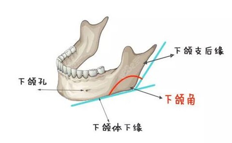 张笑天下颌角手术做得好