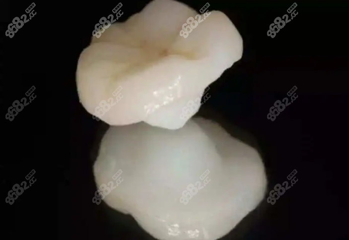 嵌体修复和补牙的区别