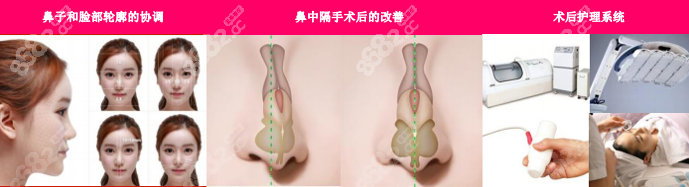 伊美芝鼻部整形手术特点