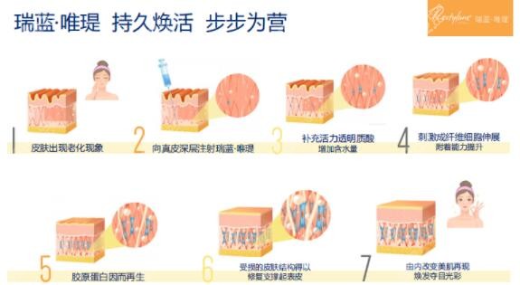 瑞蓝唯瑅到底值不值得打