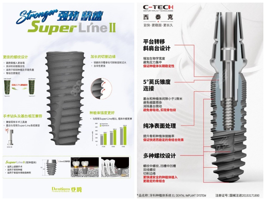 韩国登腾种植牙和意大利西泰克质量对比