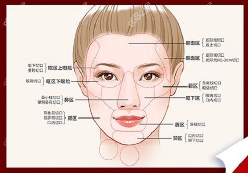 周云超多维定位清异术面部分布