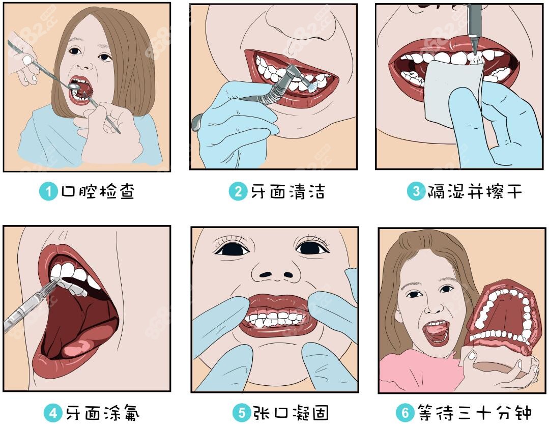 涂氟的次数跟牙齿状况有关系,具体看口腔情况