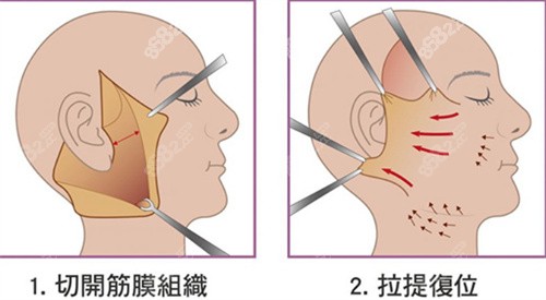 上海拉皮医生就选倪峰