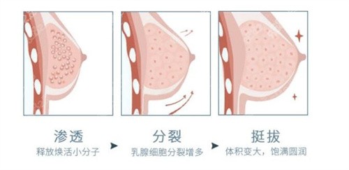 水分子丰胸原理手术图片