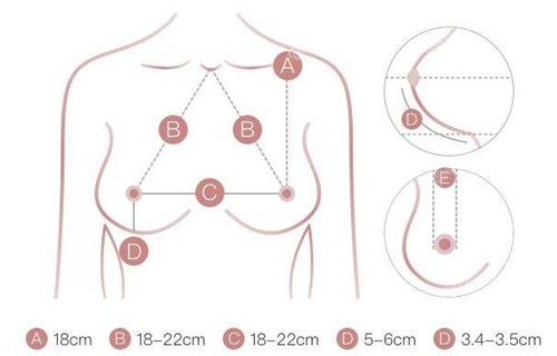 选择法国伊思雅隆胸假体大小要根据测量的胸部数据来定