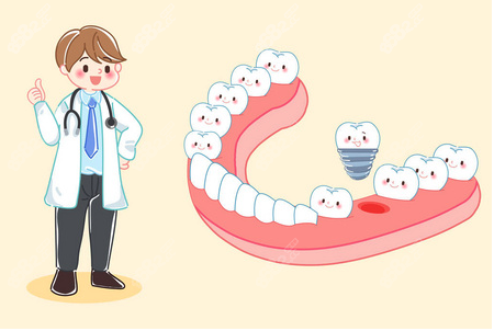 上海哪家医院种植牙便宜又好