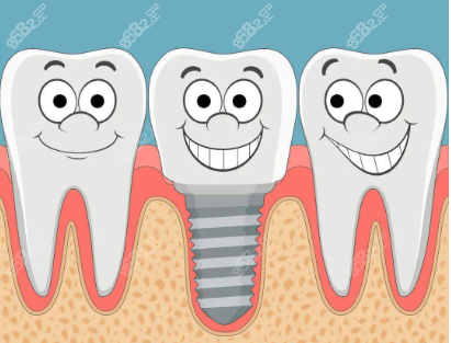 上海鼎植口腔种植牙质量怎么样