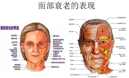 面部衰老的表现展示