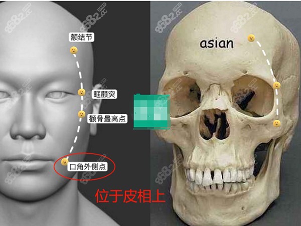 上海倪峰医生拉皮